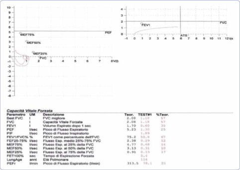 Figura 1 Prove di funzionalità respiratoria.