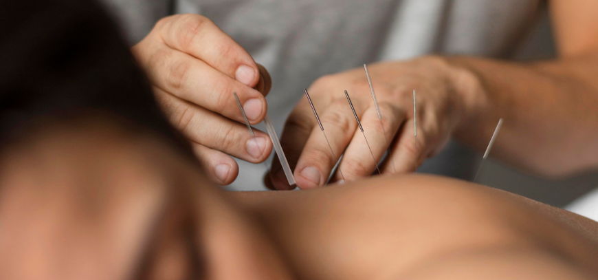 Centro medico Clinica San Giuseppe Asti - terapista agopuntura